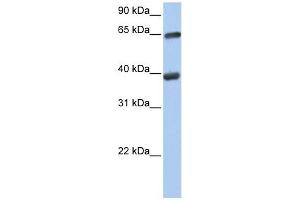 TKT antibody used at 1 ug/ml to detect target protein. (TKT 抗体)