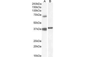 ABIN571104 (1µg/ml) staining of Peripheral Blood Mononucleocyte (A) and (0. (TRIM29 抗体  (Internal Region))