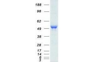 Western Blotting (WB) image for Glucokinase (Hexokinase 4) (GCK) (Transcript Variant 1) protein (Myc-DYKDDDDK Tag) (ABIN2721956)