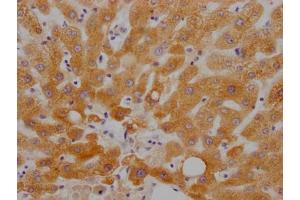 IHC image of ABIN7127790 diluted at 1:100 and staining in paraffin-embedded human liver tissue performed on a Leica BondTM system. (Recombinant RBP4 抗体)
