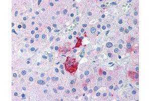 Anti-EPHX2 antibody IHC of human adrenal. (EPHX2 抗体  (N-Term))