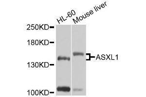 Western blot analysis of extracts of various cell lines, using ASXL1 antibody (ABIN6003622) at 1/1000 dilution. (ASXL1 抗体)