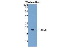 Western Blotting (WB) image for anti-Gastrokine 1 (GKN1) (AA 53-192) antibody (ABIN1859011) (Gastrokine 1 抗体  (AA 53-192))