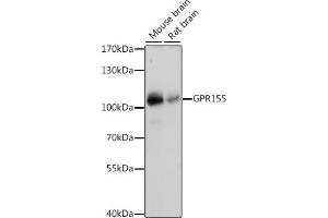 Western blot analysis of extracts of various cell lines, using GPR155 antibody (ABIN7267298) at 1:1000 dilution. (GPR155 抗体  (AA 721-870))