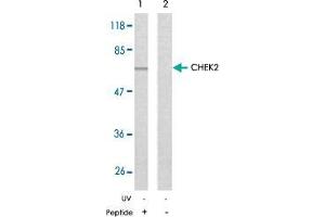 Western blot analysis of the extracts from Jurkat cells using CHEK2 polyclonal antibody  . (CHEK2 抗体)