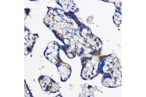 Immunohistochemistry of paraffin-embedded Human placenta using EY Rabbit pAb (ABIN6135167, ABIN6140386, ABIN6225031 and ABIN6225033) at dilution of 1:100 (40x lens). (EYA1 抗体  (AA 100-250))