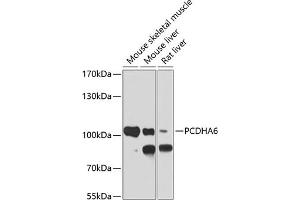 Western blot analysis of extracts of various cell lines, using PCDH antibody (ABIN6128584, ABIN6145301, ABIN6145302 and ABIN6220787) at 1:1000 dilution. (PCDHA6 抗体  (AA 1-230))