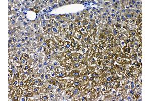 Immunohistochemistry (IHC) image for anti-Cytochrome P450, Family 2, Subfamily D, Polypeptide 6 (CYP2D6) (AA 315-347), (C-Term) antibody (ABIN5518823)