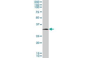 SIX3 monoclonal antibody (M08), clone 2B9. (SIX3 抗体  (AA 273-332))