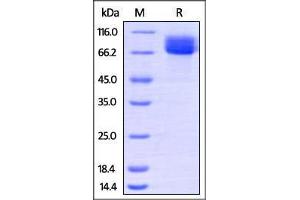 SDS-PAGE (SDS) image for Mast/stem Cell Growth Factor Receptor (KIT) (AA 26-516) (Active) protein (His tag) (ABIN2870617)