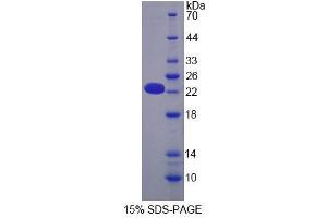 SDS-PAGE analysis of Mouse OPA3 Protein. (OPA3 蛋白)