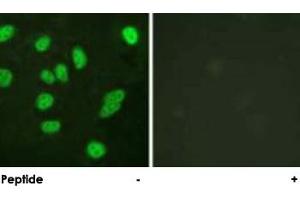 Immunofluorescence analysis of HeLa cells, using MYBL2 polyclonal antibody . (MYBL2 抗体)