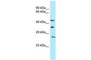 Image no. 1 for anti-U6 SnRNA Biogenesis 1 (USB1) (AA 150-199) antibody (ABIN6747953) (C16orf57 抗体  (AA 150-199))