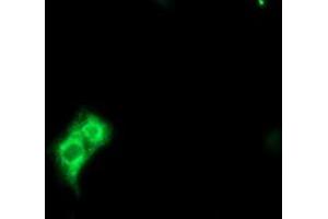 Image no. 7 for anti-Methionyl Aminopeptidase 2 (METAP2) (AA 2-212) antibody (ABIN1491153)