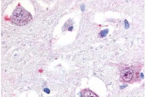 Anti-ROR Beta antibody  ABIN1049296 IHC staining of human brain, thalamus. (RORB 抗体  (Hinge Region))