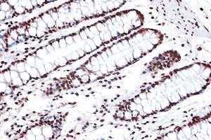 Immunohistochemistry of paraffin-embedded human colon using FUBP1 Rabbit mAb (ABIN7267128) at dilution of 1:100 (40x lens). (FUBP1 抗体)