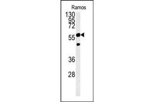 PHGDH Antibody (Center) (ABIN650767 and ABIN2839544) western blot analysis in Ramos cell line lysates (15 μg/lane). (PHGDH 抗体  (AA 249-277))