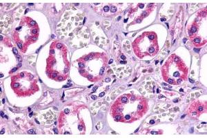 Anti-TAAR6 antibody  ABIN1049384 IHC staining of human kidney, renal tubules. (TAAR6 抗体  (Cytoplasmic Domain))