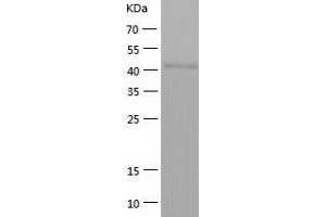 Western Blotting (WB) image for Keratin 7 (KRT7) (AA 276-469) protein (His-IF2DI Tag) (ABIN7123678) (Cytokeratin 7 Protein (AA 276-469) (His-IF2DI Tag))