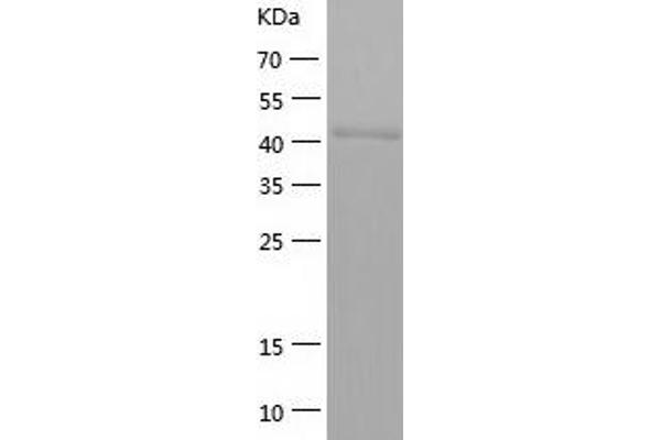 Cytokeratin 7 Protein (AA 276-469) (His-IF2DI Tag)