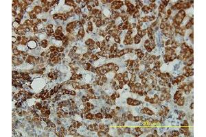 Image no. 1 for anti-Aldehyde Dehydrogenase 4 Family, Member A1 (ALDH4A1) (AA 1-564) antibody (ABIN599053) (ALDH4A1 抗体  (AA 1-564))