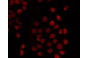 ABIN6266725 staining COS7 by IF/ICC. (TADA2L 抗体)