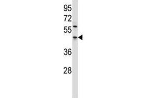PDCD4 antibody western blot analysis in HL-60 lysate. (PDCD4 抗体  (AA 121-149))