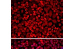 Immunofluorescence analysis of U2OS cells using NCOA1 Polyclonal Antibody (NCOA1 抗体)
