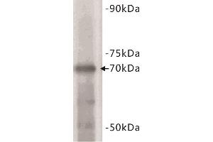 Western Blotting (WB) image for anti-Estrogen Receptor 1 (ESR1) (C-Term) antibody (ABIN1854892) (Estrogen Receptor alpha 抗体  (C-Term))