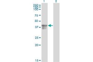 Western Blotting (WB) image for anti-serpin Peptidase Inhibitor, Clade B (Ovalbumin), Member 3 (SERPINB3) (AA 276-390) antibody (ABIN562799)