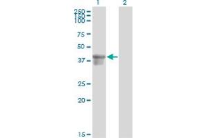 Western Blot analysis of SERPINB3 expression in transfected 293T cell line by SERPINB3 monoclonal antibody (M01), clone 2F5. (SERPINB3 抗体  (AA 276-390))