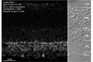 Indirect immunostaining of a PFA fixed mouse retina section (dilution 1 : 1000) (GLRB 抗体  (AA 336-355, AA 336-455))