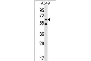 ZN Antibody (Center) (ABIN656365 and ABIN2845663) western blot analysis in A549 cell line lysates (35 μg/lane). (ZNF248 抗体  (AA 276-304))