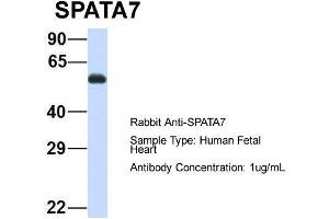 Host: Rabbit  Target Name: SPATA7  Sample Tissue: Human Fetal Heart  Antibody Dilution: 1. (SPATA7 抗体  (Middle Region))