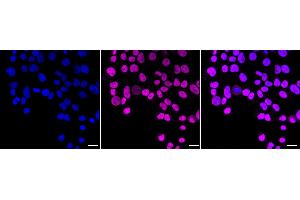 anti-Bromodomain Containing 2 (BRD2) antibody