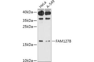 Western blot analysis of extracts of various cell lines, using FB antibody (ABIN7267107) at 1:1000 dilution. (FAM127B 抗体  (AA 1-113))