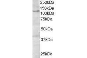 ABIN185260 (1µg/ml) staining of A431 lysate (35µg protein in RIPA buffer). (HPS3 抗体  (C-Term))