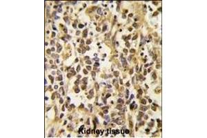 Formalin-fixed and paraffin-embedded human kidney tissue reacted with the primary antibody, which was peroxidase-conjugated to the secondary antibody, followed by DAB staining. (DNMT3A 抗体  (AA 457-486))