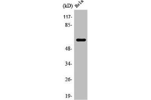 Western Blot analysis of HuvEc cells using Rabaptin-5β Polyclonal Antibody (RABEP2 抗体  (Internal Region))