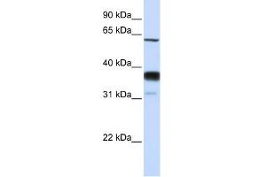 SMPD3 antibody used at 1 ug/ml to detect target protein. (SMPD3 抗体)