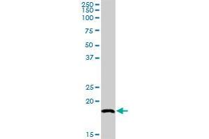 SNX12 MaxPab rabbit polyclonal antibody. (SNX12 抗体  (AA 1-172))