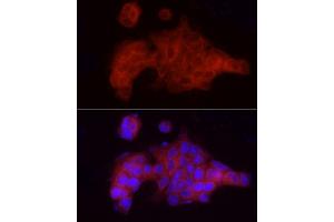 Immunofluorescence analysis of MCF7 cells using VEGFR3/FLT4 Rabbit pAb (ABIN6130779, ABIN6140698, ABIN6140701 and ABIN6217251) at dilution of 1:100 (40x lens).