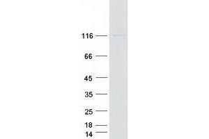 Western Blotting (WB) image for Protein tyrosine Phosphatase, Receptor Type, N Polypeptide 2 (PTPRN2) (Transcript Variant 2) protein (Myc-DYKDDDDK Tag) (ABIN2712354)