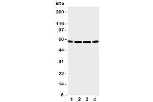 Western blot testing of P2X6 antibody and Lane 1:  U87 (P2RX6 抗体  (C-Term))