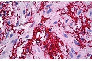 Human Prostate, Extra Cellular Matrix: Formalin-Fixed, Paraffin-Embedded (FFPE) (Fibrillin 1 抗体  (AA 45-450))