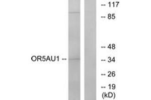 Western blot analysis of extracts from Jurkat cells, using OR5AU1 Antibody.