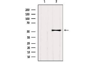 Western blot analysis of extracts from HepG2, using GPR89A Antibody. (GPR89A 抗体)