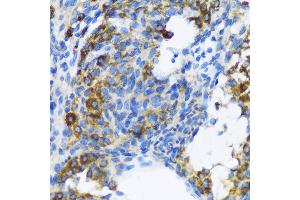 Immunohistochemistry of paraffin-embedded Rat ovary using PTCH1 antibody (ABIN1682368, ABIN1682367, ABIN3015342, ABIN3015343 and ABIN6213997) at dilution of 1:100 (40x lens). (Patched 1 抗体  (AA 1214-1312))
