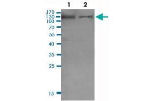 Western Blot (Cell lysate) analysis of (1) KB cell lysate and (2) PC-3 cell lysate. (INPP5D 抗体  (pTyr1021))