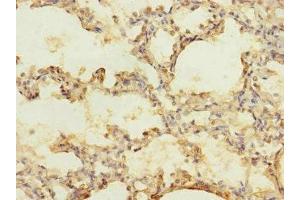 Immunohistochemistry of paraffin-embedded human lung tissue using ABIN7175581 at dilution of 1:100 (CACNA2D2 抗体  (AA 20-200))